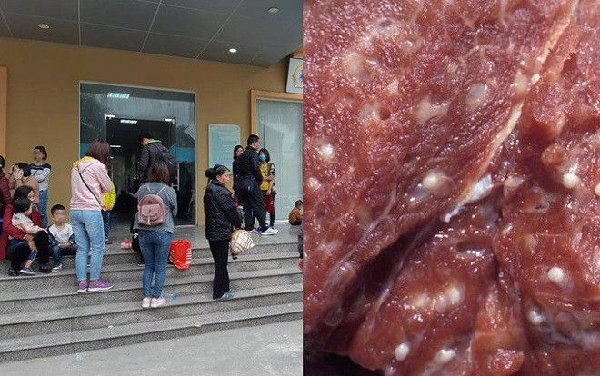 Bệnh nhiễm sán lợn khiến hơn 400 phụ huynh ở Bắc Ninh đưa con đi xét nghiệm nguy hiểm tới mức nào? Ảnh 2