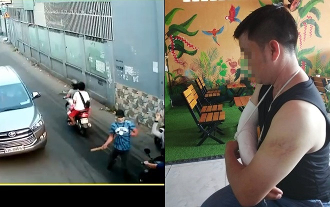 Đang đi mua đồ ăn sáng, người đàn ông bị 4 người lạ truy sát trọng thương giữa phố Sài Gòn Ảnh 2