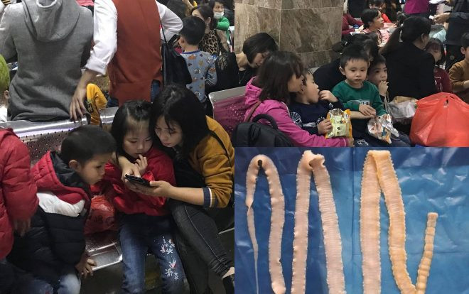 Bộ Y tế: Sán trưởng thành có thể dài đến 12m, ký sinh trong ruột non nhiều năm Ảnh 2