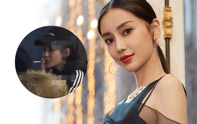 Chấn thương gãy ngón tay nhưng hành động hút thuốc lá phì phèo của Angelababy lại gây chú ý hơn cả! Ảnh 2