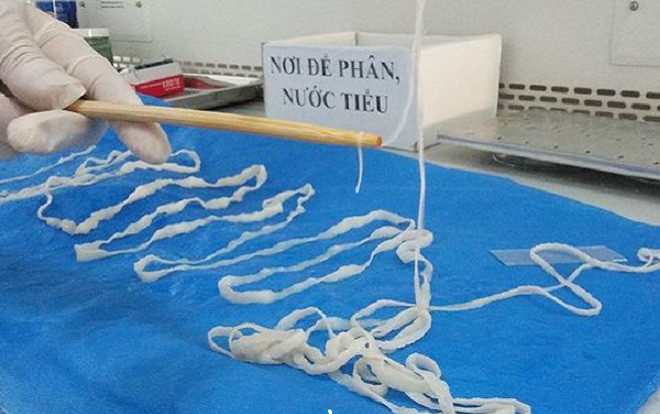 Kinh hãi phát hiện sán dây dài hơn 5 mét trong cơ thể một giáo viên ở Sài Gòn Ảnh 2