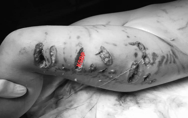 Hà Nội: Chó Pitbull bất ngờ giật tung xích, lao vào tấn công bé gái 2 tuổi đang chơi trước cổng nhà Ảnh 2