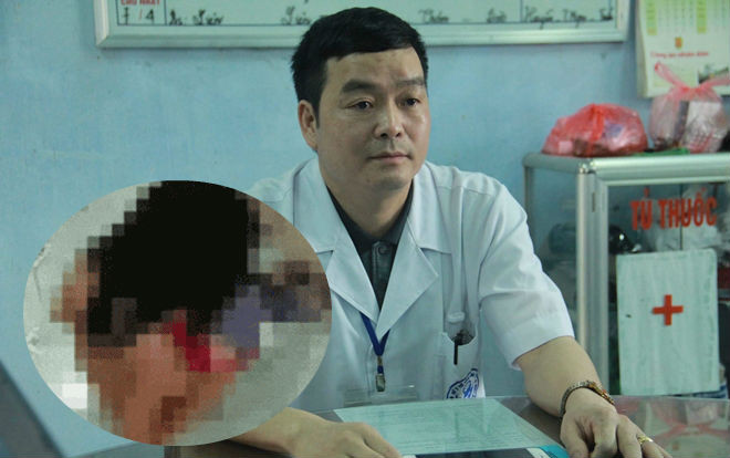 Nữ sinh lớp 9 bị 5 học sinh lột quần áo, hành hung bị sang chấn tâm lý Ảnh 2