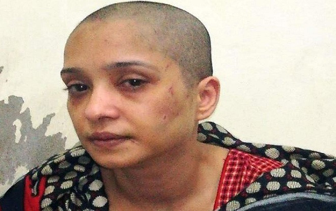 Chồng bạo hành vợ dã man vì không chịu mua vui cho đám bạn, thái độ của cảnh sát còn đáng căm phẫn hơn Ảnh 2