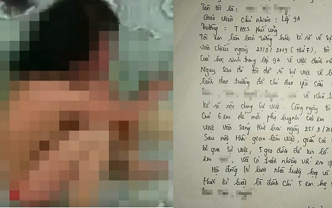 Phẫn nộ bản tường trình 'ém thông tin' của cô giáo chủ nhiệm trong vụ nữ sinh Hưng Yên bị bạn đánh hội đồng Ảnh 2