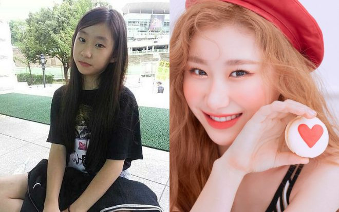 Ăn gạch ầm ầm vì nghi án phẫu thuật thẩm mĩ, hình ảnh quá khứ của ITZY lại chứng minh điều ngược lại Ảnh 2