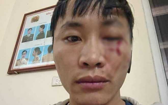 Giao hàng muộn, nam shipper bị khách cầm điếu cày phang chảy máu mặt: ‘Mày thích để tao chờ à’ Ảnh 2