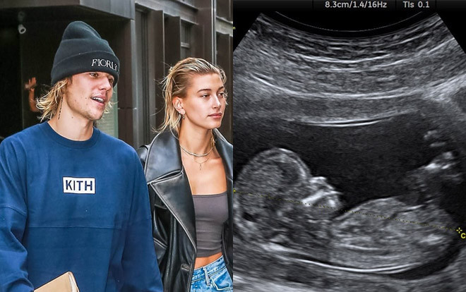 Lừa fan bằng cách 'chơi ngông' không suy nghĩ, Justin Bieber hứng chịu 'kết đắng' Ảnh 2