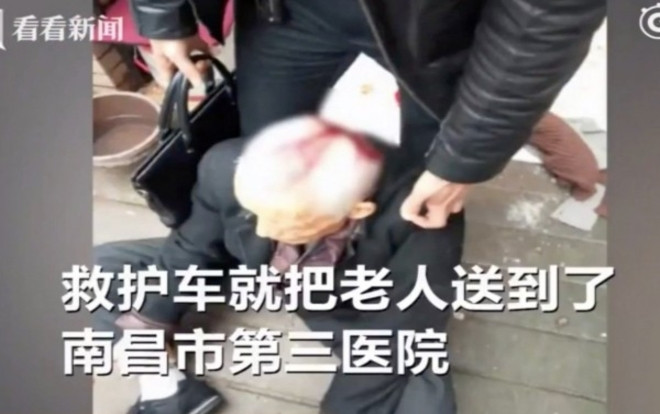 Hy hữu: Đi bộ trên đường, cụ ông gặp họa vì bị xe đạp rơi trúng đầu Ảnh 2