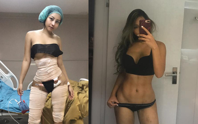 Cô gái chi tiền khủng đại phẫu thuật thẩm mỹ đau đớn để rồi sắc vóc khiến ai cũng kinh ngạc thảng thốt Ảnh 2