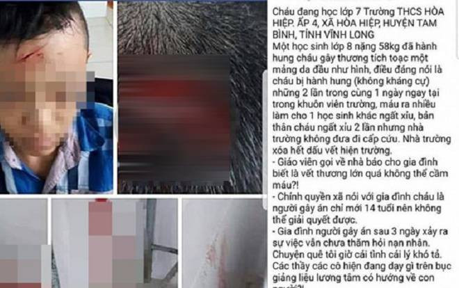 Nam sinh lớp 7 bị bạn đánh, đập đầu vào cửa kính đến ngất xỉu ngay tại trường học Ảnh 2