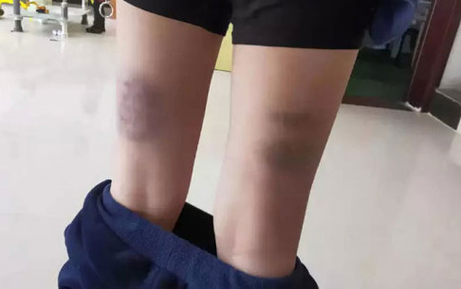 Phẫn nộ với hình phạt học tập của giáo viên: Thấp hơn 1 điểm đánh 10 roi, có em bị đánh tới 840 roi Ảnh 2