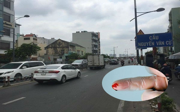 Dân Sài Gòn hoang mang trước vụ kẻ 'điên' đâm vật nhọn khiến 10 người điều trị phơi nhiễm HIV Ảnh 2