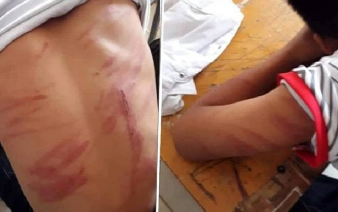 Vụ bé trai bị bố ruột bạo hành đến mức ngất xỉu, nhập viện: 'Ông ấy đánh cháu hơn 30 phút' Ảnh 2