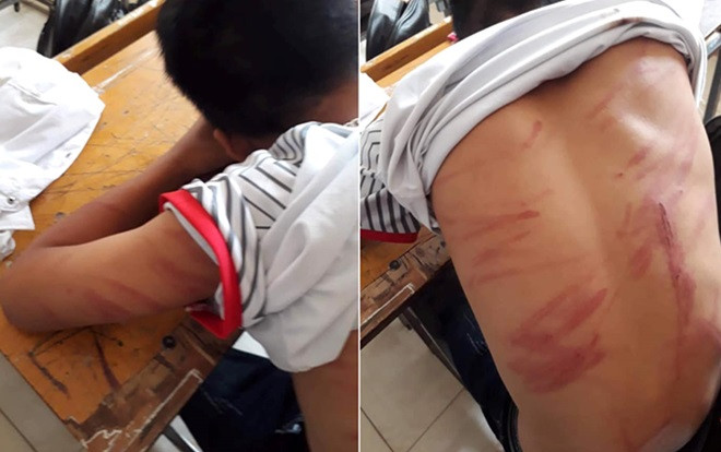 Người bố đánh con ngất xỉu phải nhập viện khai gì tại cơ quan công an? Ảnh 2