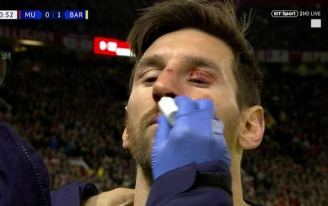 Cận cảnh tình huống Messi 'đổ máu' trong tình huống va chạm với Smalling Ảnh 2