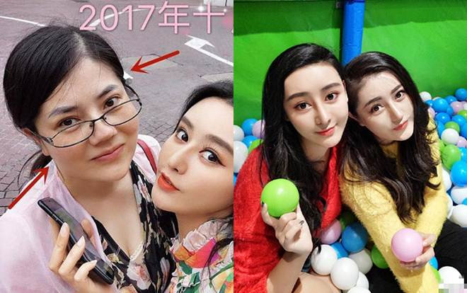 Phẫu thuật thẩm mỹ y hệt Địch Lệ Nhiệt Ba, người phụ nữ 42 tuổi đổi đời Ảnh 2