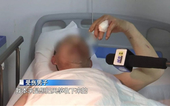 Đi thả diều, nam thanh niên bị đứt lìa 3 ngón tay vì gió quá mạnh Ảnh 2