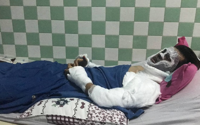 Việt kiều bị tạt axit, cắt gân chân: Chưa tìm ra thủ phạm, nạn nhân sống trong sợ hãi Ảnh 2