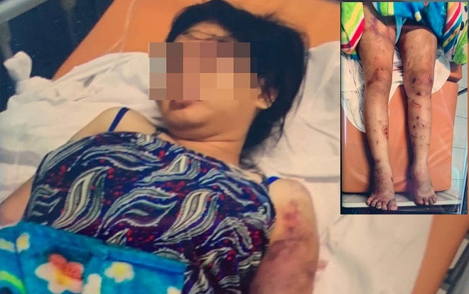 Vụ cô gái trẻ bị 'bắt cóc', tra tấn đến sinh non ở Sài Gòn: Đối tượng khai đã sử dụng ma túy trong lúc hành sự Ảnh 2