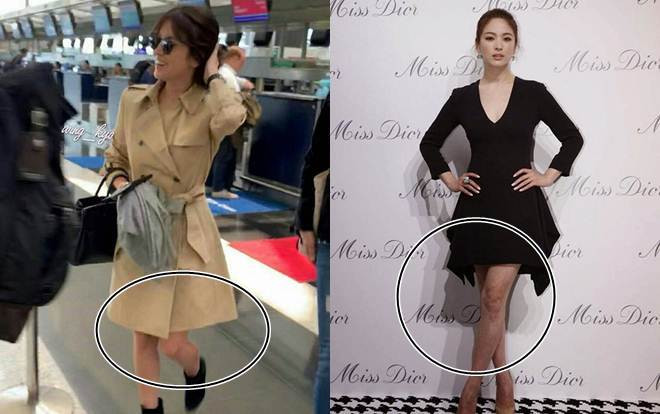 Xinh đẹp là thế nhưng Song Hye Kyo liên tiếp bị chiếc 'đầu gối củ lạc' làm hại Ảnh 2