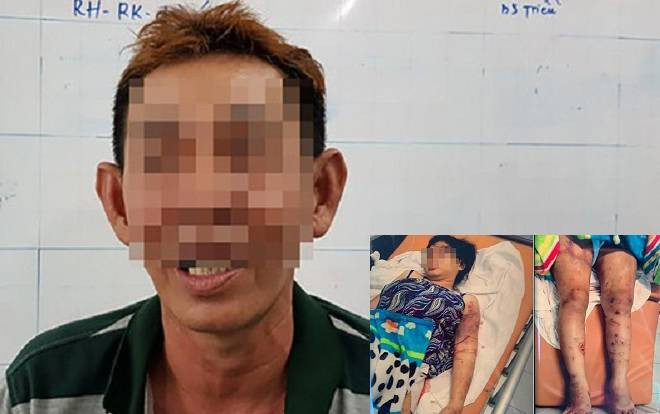 Vụ thai phụ bị tra tấn dã man suốt 20 ngày đến sẩy thai: Cha nạn nhân tiết lộ sự thật số tiền nợ một triệu mấy… Ảnh 2