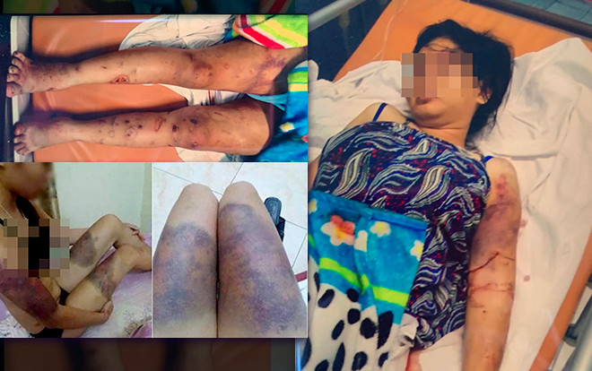 Rùng rợn lời kể của thai phụ bị 'bắt cóc', tra tấn suốt 20 ngày đến sẩy thai: 'Lúc con không còn đạp nữa, tôi năn nỉ thả về nhưng không được' Ảnh 2