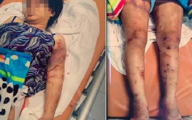 Khởi tố, bắt tạm giam đối tượng tham gia 'bắt cóc', đánh đập bà bầu suốt 20 ngày dẫn đến sảy thai Ảnh 2