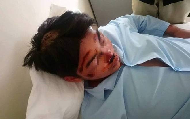 Nam sinh lớp 11 bị nhóm bạn dùng dao chém vào đầu và mặt trọng thương Ảnh 2