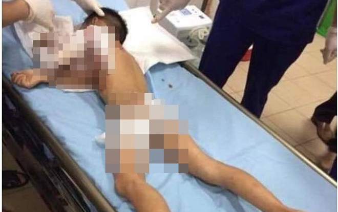 Bé trai 7 tuổi bị chó nhà nuôi cắn tử vong Ảnh 2