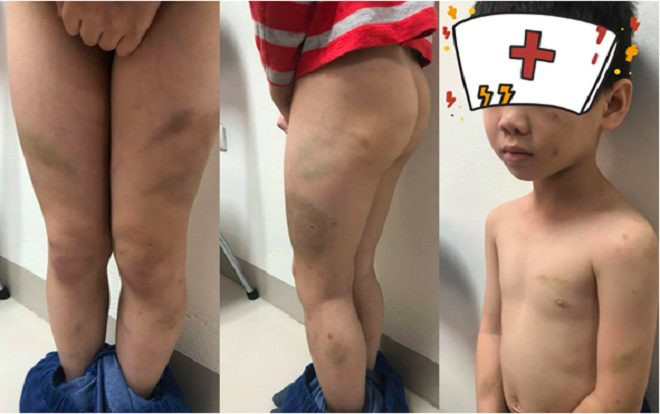 Mẹ ruột cháu bé 7 tuổi bị bố và mẹ kế bạo hành đau đớn gửi đơn đến BV Việt Đức đề nghị can thiệp Ảnh 2