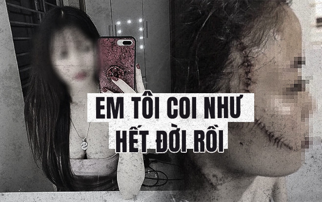 Chị gái thiếu nữ bị nhóm bạn cũ rạch mặt, khâu 60 mũi: 'Như thế thì em tôi coi như hết đời người rồi…' Ảnh 2