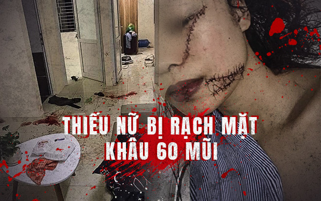 Vụ rạch mặt bạn cũ khiến khâu 60 mũi: 'Không có chuyện chúng tôi bẫy Q. vào phòng để ra tay' Ảnh 2