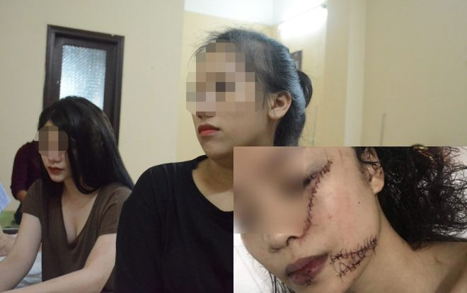 Nhóm cô gái đại chiến khiến thiếu nữ phải khâu 60 mũi: Chỉ đến phòng đòi tủ lạnh, không chủ ý đánh nhau Ảnh 2