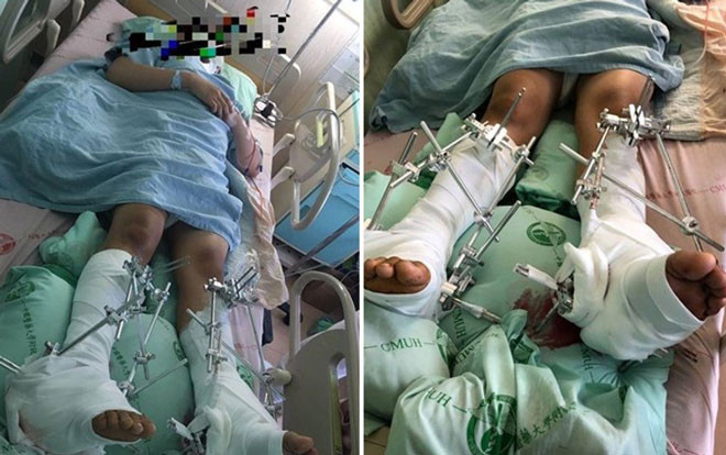 Nam sinh nhảy lầu tự tử vì bị bắt nạt nhưng thái độ của thầy hiệu trưởng mới thực sự gây phẫn nộ Ảnh 2