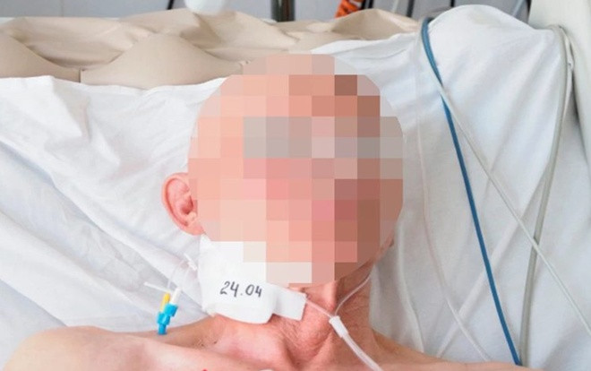 Bị đóng băng toàn thân, nạn nhân thoát khỏi cõi chết bằng cú sốc điện 5000 volt Ảnh 2