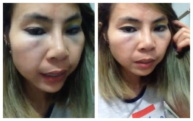 Sau khi tách khỏi con trai, 'hot girl' Bella lên mạng tố bị đánh bầm tím mặt mũi và sự thật đằng sau Ảnh 2