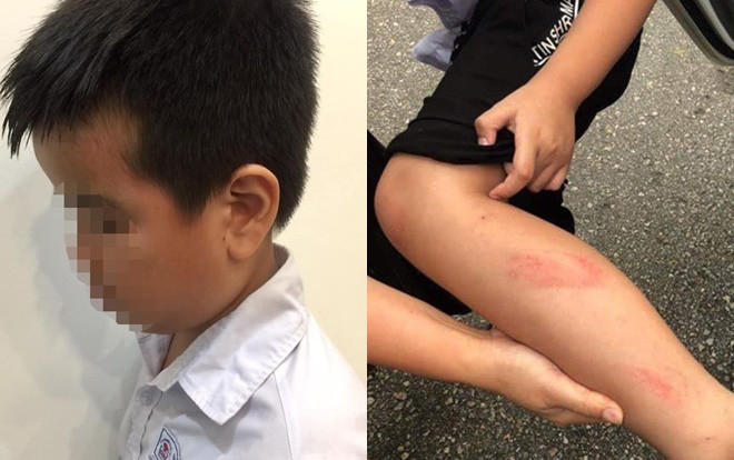 Đình chỉ công tác 6 tháng nữ giáo viên đánh tấy đỏ chân và mặt nam sinh lớp 2 trong giờ kiểm tra Ảnh 2