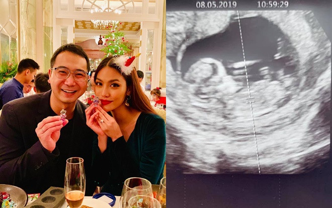 John Tuấn Nguyễn xác nhận bà xã Lan Khuê đang mang thai con đầu lòng Ảnh 2