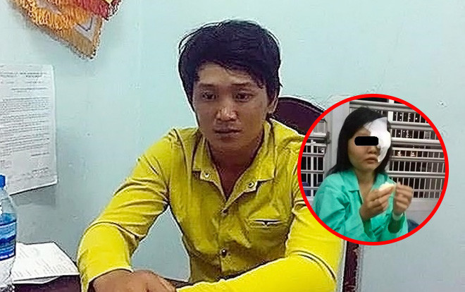 Vụ nữ sinh 15 tuổi bị 'yêu râu xanh' đánh mù mắt để giở trò đồi bại: Bố đẻ nạn nhân làm đơn kháng cáo Ảnh 2