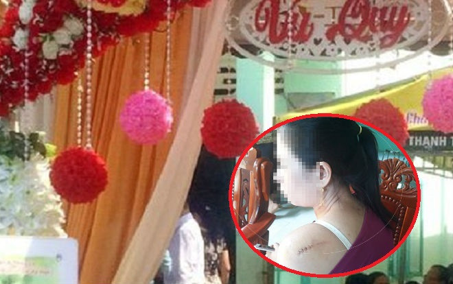 Cô dâu bàng hoàng kể lại giây phút bị chồng cũ xông vào chém tới tấp trong ngày cưới Ảnh 2