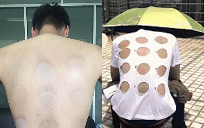 Chàng trai phơi mình giữa cái nắng 40 độ để test hiệu quả của kem chống nắng Ảnh 2