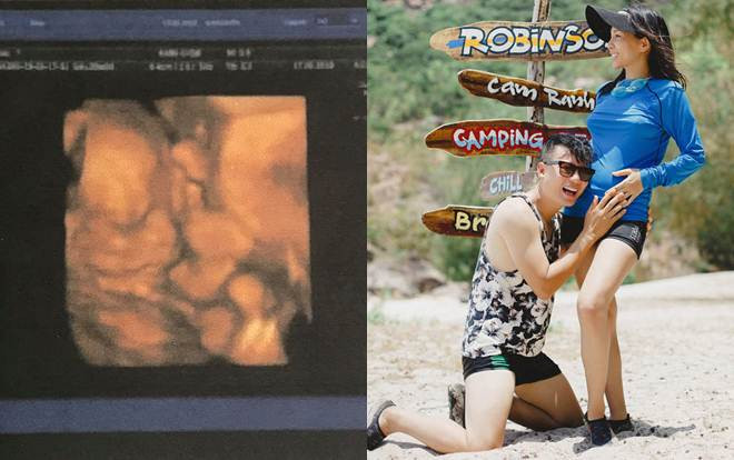 Hoàng Bách khoe ảnh siêu âm đứa con thứ ba, mặt giống hệt bố Ảnh 2