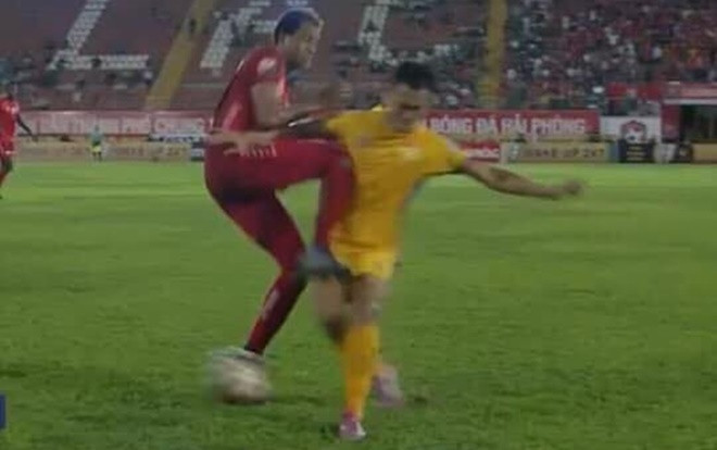 Cựu cầu thủ U23 Việt Nam bị ngoại binh Hải Phòng đá gãy xương Ảnh 2