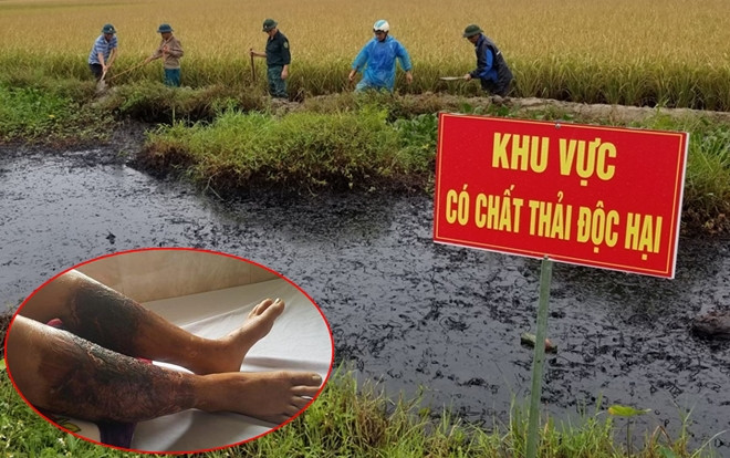 Hải Phòng: Truy tìm đối tượng đổ trộm chất thải độc ra mương nước khiến một người dân bị bỏng nặng Ảnh 2