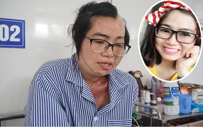 Cuộc sống hiện tại của cô giáo xinh đẹp từng bị chồng cũ tạt axit trước mặt con: ‘Tôi mong sớm tìm lại chính mình và đứng trên bục giảng’ Ảnh 2