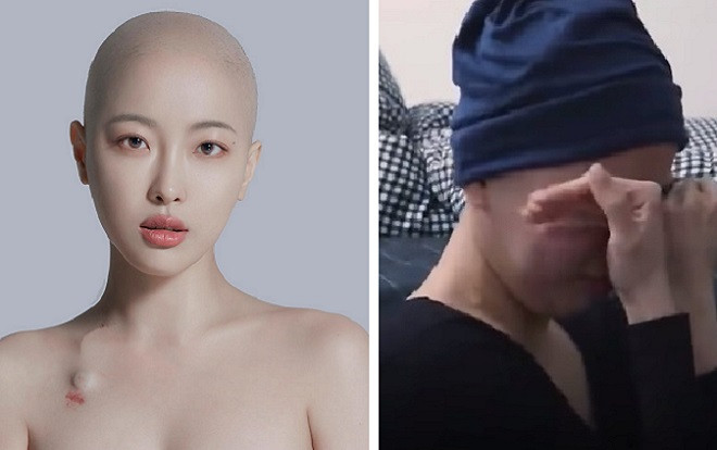 Nữ beauty blogger Hàn Quốc làm clip hướng dẫn make up dành cho người bị ung thư, lý do phía sau thật sự cảm động Ảnh 2