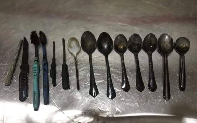 Phàn nàn về cơn đau bụng, bác sĩ choáng váng khi lấy ra 14 vật thể trong bụng người đàn ông Ảnh 2