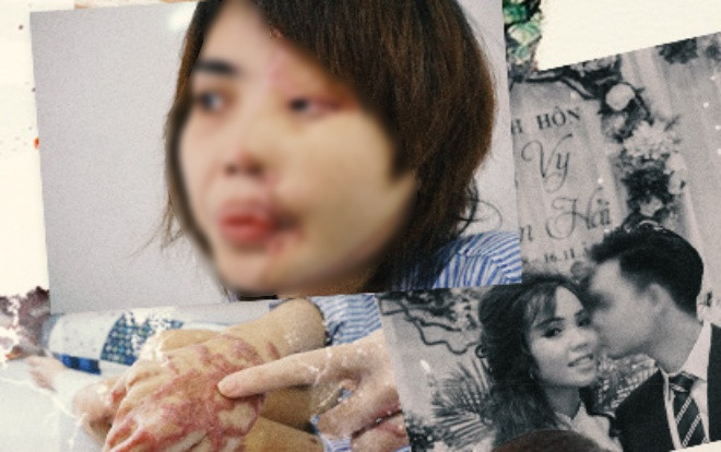 Cô gái xinh đẹp bị chồng sắp cưới là thiếu úy Công an tạt axit: ‘Có người đặt điều nói tôi thêu dệt, bịa chuyện để câu like' Ảnh 2