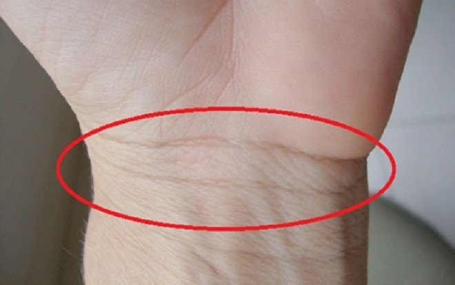 Dành 1 phút xem ngấn cổ tay đoán ngay tương lai sang hèn, sức khỏe mạnh hay yếu Ảnh 2